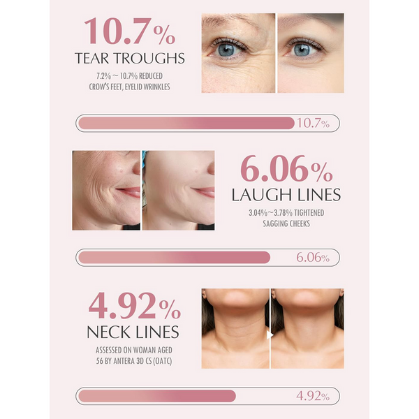 Joyliveo Wrinkle Multi Balm Stick